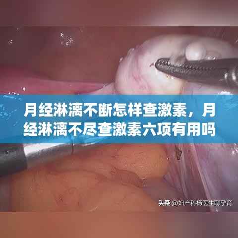 月经淋漓不断怎样查激素,月经淋漓不尽查激素六项有用吗